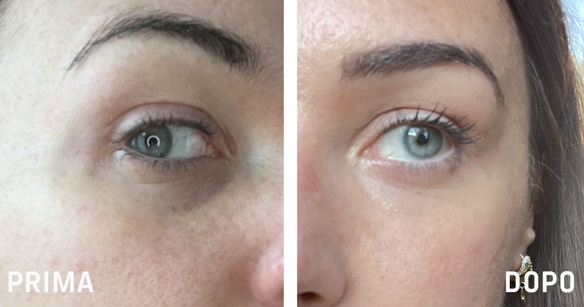 Guendalina Before-after_web_article_prima_dopo_1140x600_0822.jpg